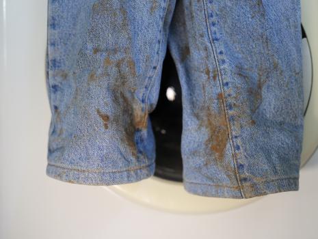 Leke Sökücü Ürünler